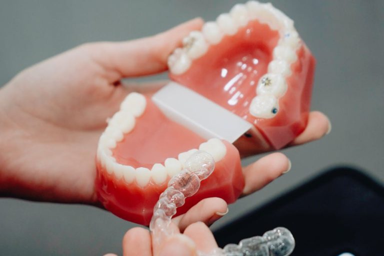 Invisalign