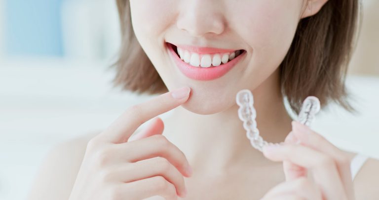 Vivera Retainers